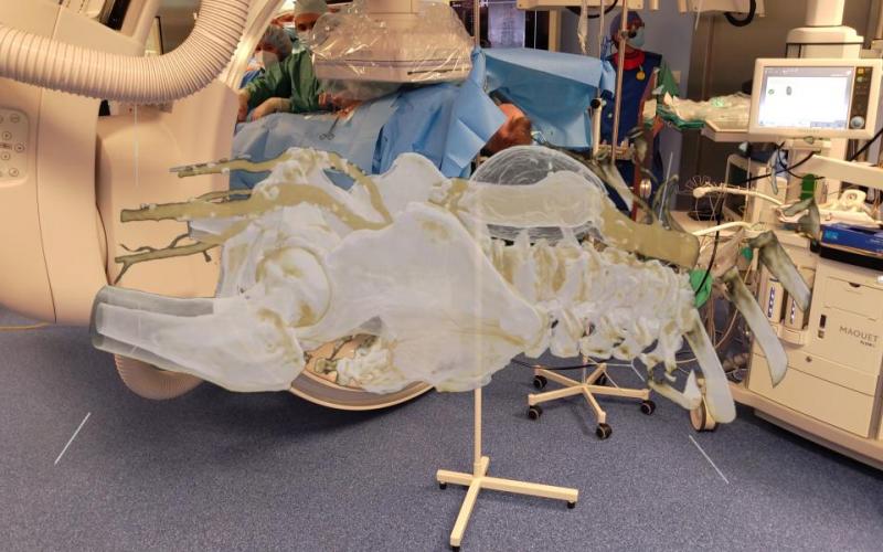 obraz 3D z gogli podczas operacji